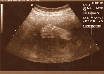 baby girl 27 weeks-foot.png