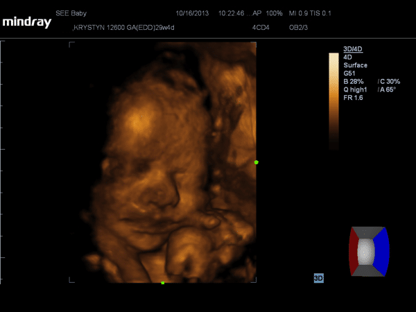 See baby ultrasound baby girl #4