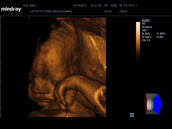 Seebaby ultrasound image girl #4