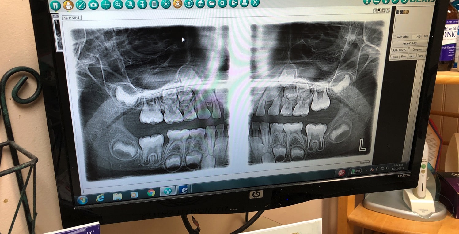 kids dentist versus family dentist